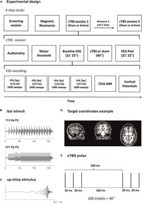 Effects of cTBS on the Frequency-Following Response and Other Auditory Evoked Potentials